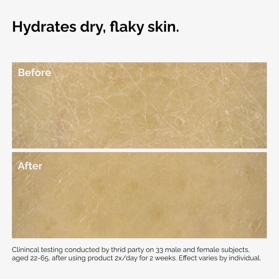 the-body-care-collection-e9 ord-natural-moisturizing-factors-inulin-body-before-after-graphic-02.jpg