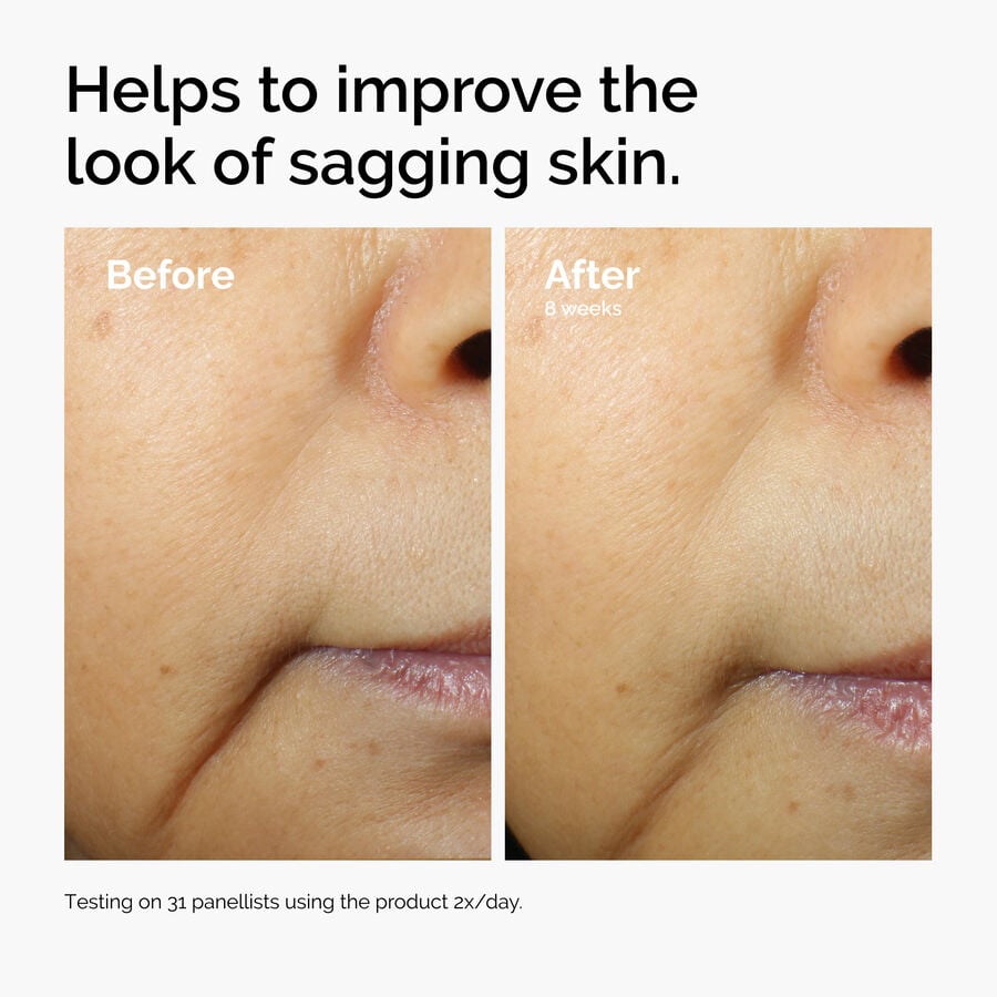 caffeine-3-escin-1-face-serum-w3 ord-caffeine-3pct-escin-1pct-face-serum-before-after-sagging.jpg