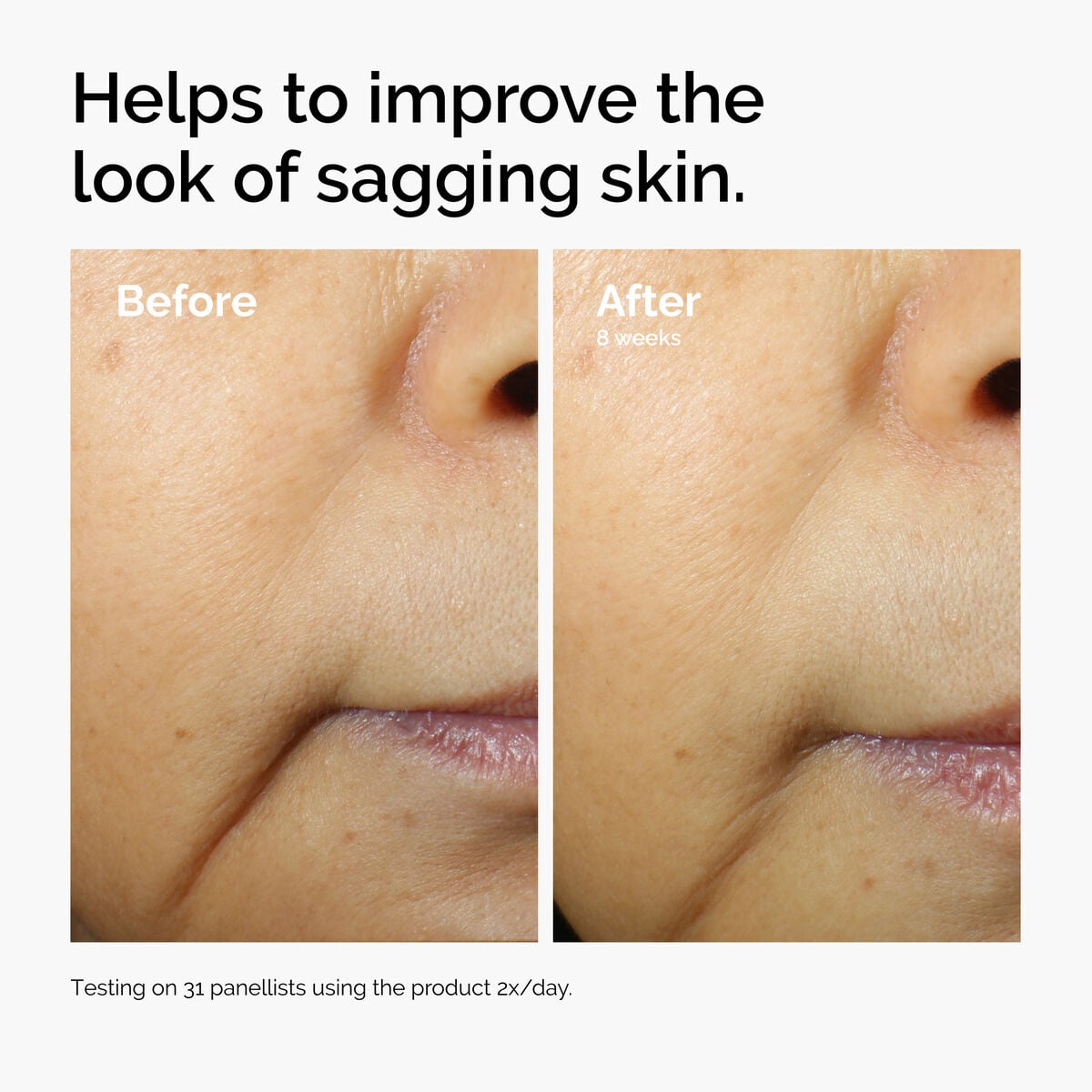 caffeine-3-escin-1-face-serum-w3 ord-caffeine-3pct-escin-1pct-face-serum-before-after-sagging.jpg