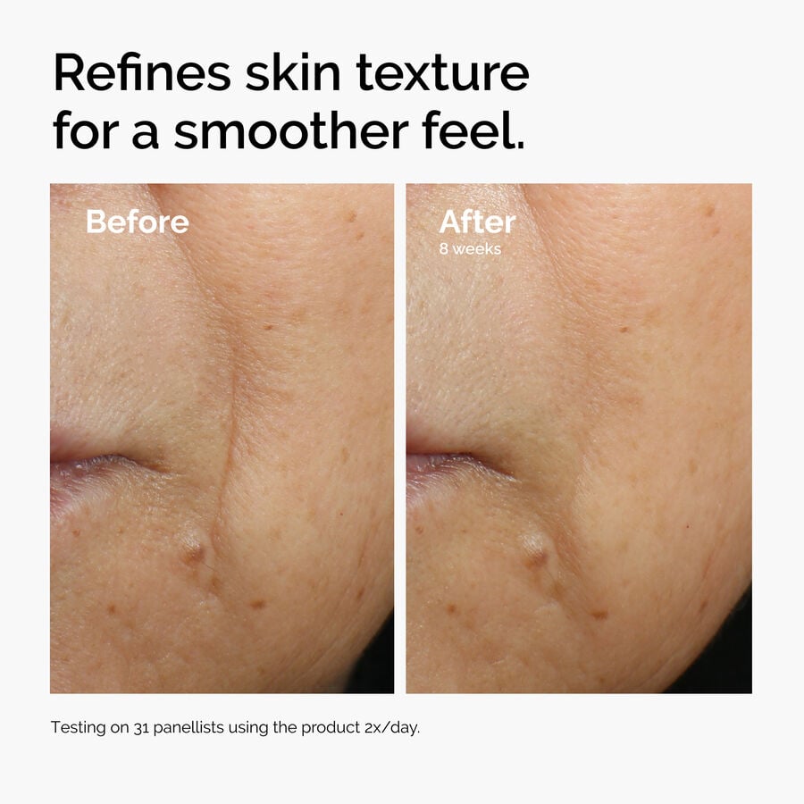 caffeine-3-escin-1-face-serum-w3 ord-caffeine-3pct-escin-1pct-face-serum-before-after-texture.jpg