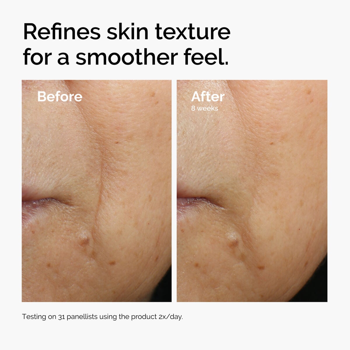 caffeine-3-escin-1-face-serum-w3 ord-caffeine-3pct-escin-1pct-face-serum-before-after-texture.jpg