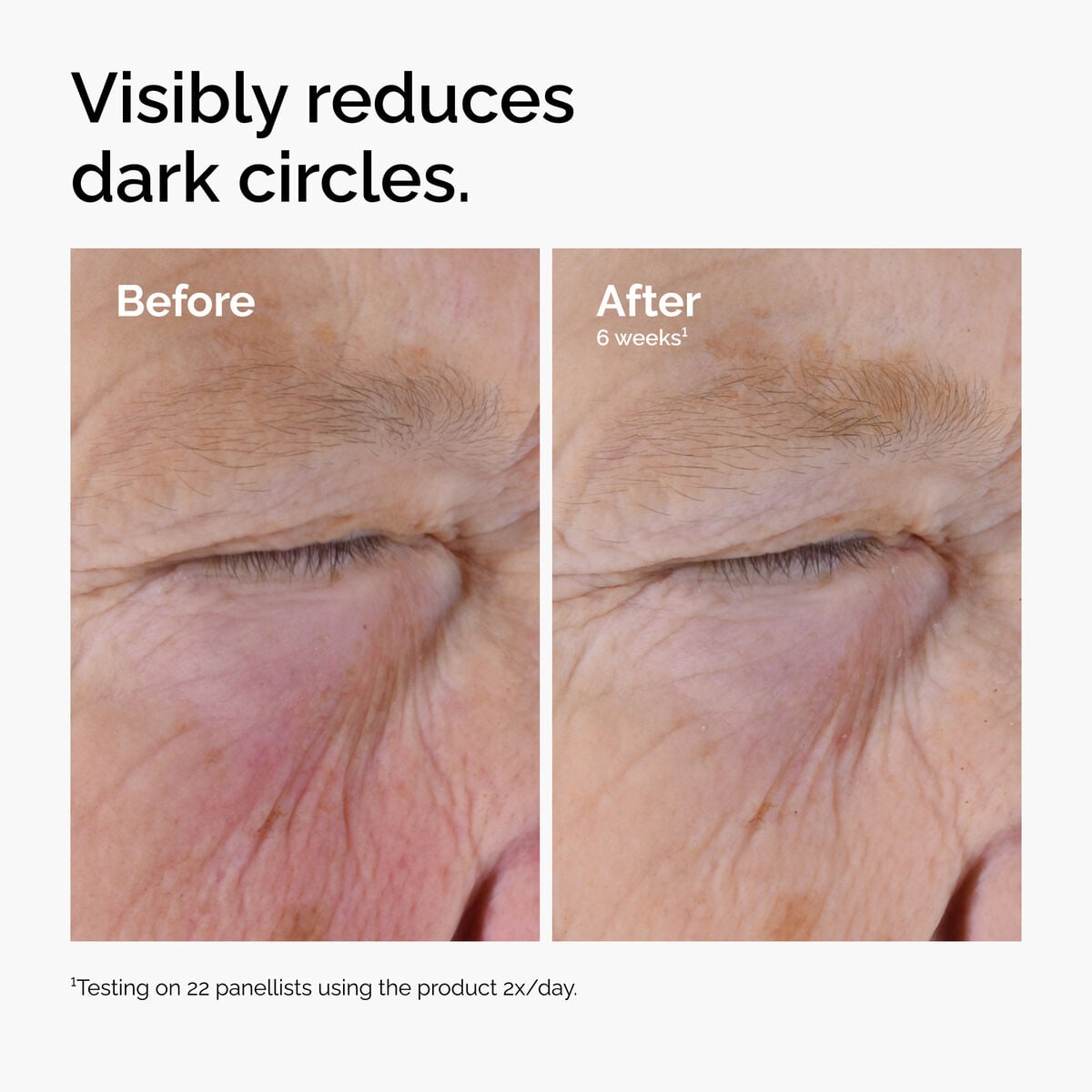 caffeine-solution-5-egcg-eye-serum-o0 ord-caffeine-solution-egcg-dark-circles-before-after.jpg