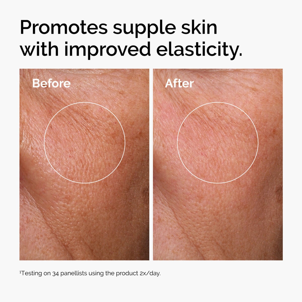 hyaluronic-acid-2-b5-with-ceramides-p1 ord-hyaluronic-acid-2pct-b5-hydrating-serum-before-after-elasticity.jpg