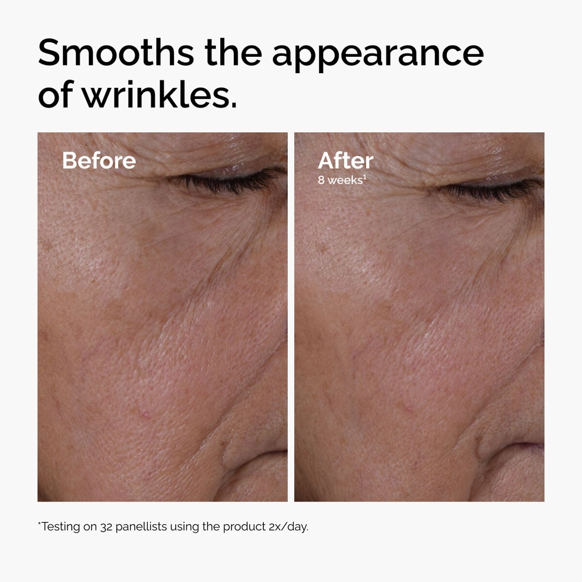 multi-peptide-ha-serum-d4 ord-multi-peptide-ha-serum-wrinkles-before-after.jpg