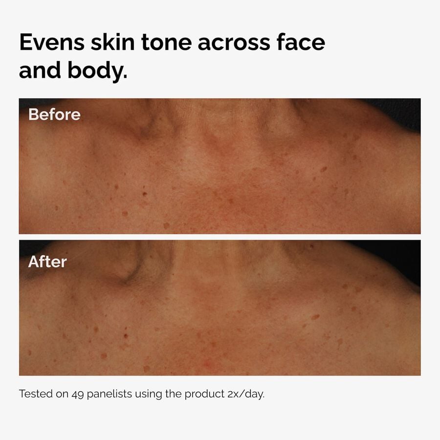 the-body-care-collection-e9 ord-niacinamide-face-body-serum-before-after-even-tone-graphic.jpg