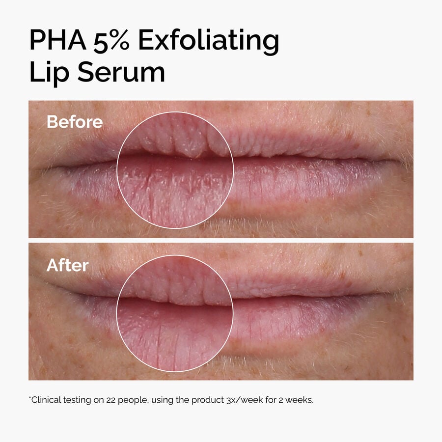 pha-5-exfoliating-lip-serum-m4 ord-pha-5pct-lip-exfoliating-serum-before-after.jpg